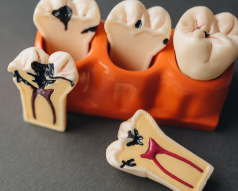 Teeth